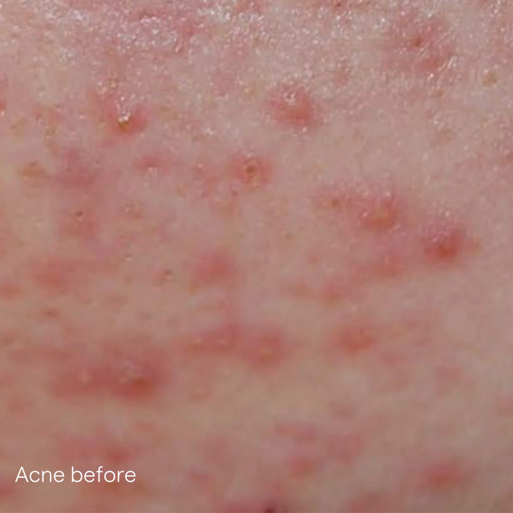 Load image into Gallery viewer, IS Clinical Active Serum