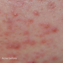 Load image into Gallery viewer, IS Clinical Active Serum