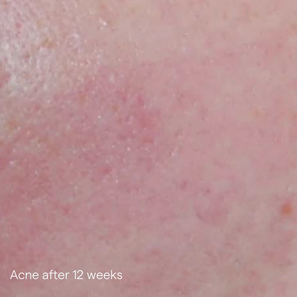 Load image into Gallery viewer, IS Clinical Active Serum