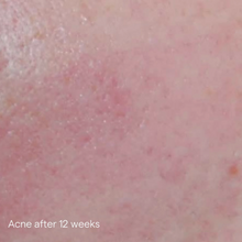 Load image into Gallery viewer, IS Clinical Active Serum