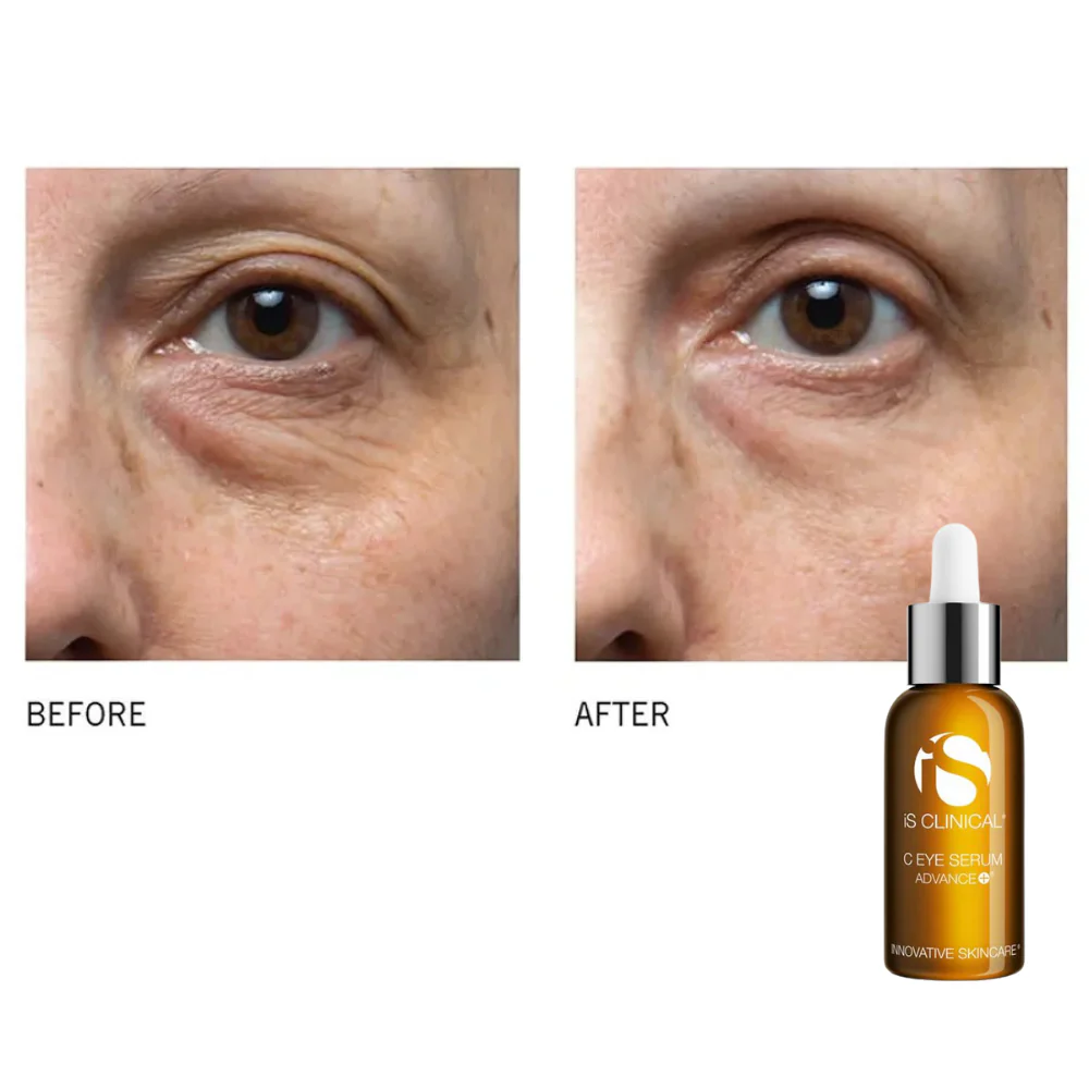 Load image into Gallery viewer, IS Clinical C Eye Serum Advance+ 15ml