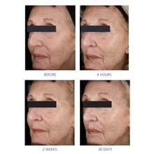 Load image into Gallery viewer, IS Clinical Youth Eye Complex 15g