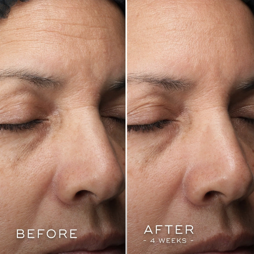Load image into Gallery viewer, Medik8 C-Tetra Luxe 30ml