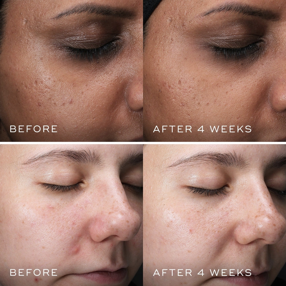 Load image into Gallery viewer, Medik8 Clarity Peptides 30ml