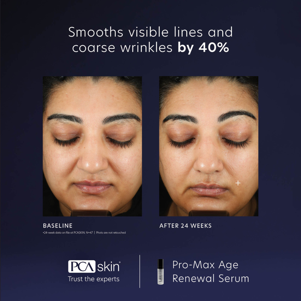 Load image into Gallery viewer, PCA Skin ProMax Age Renewal Serum 29ml