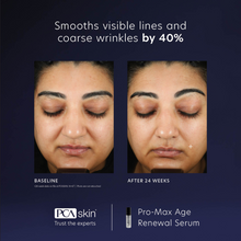 Load image into Gallery viewer, PCA Skin ProMax Age Renewal Serum 29ml