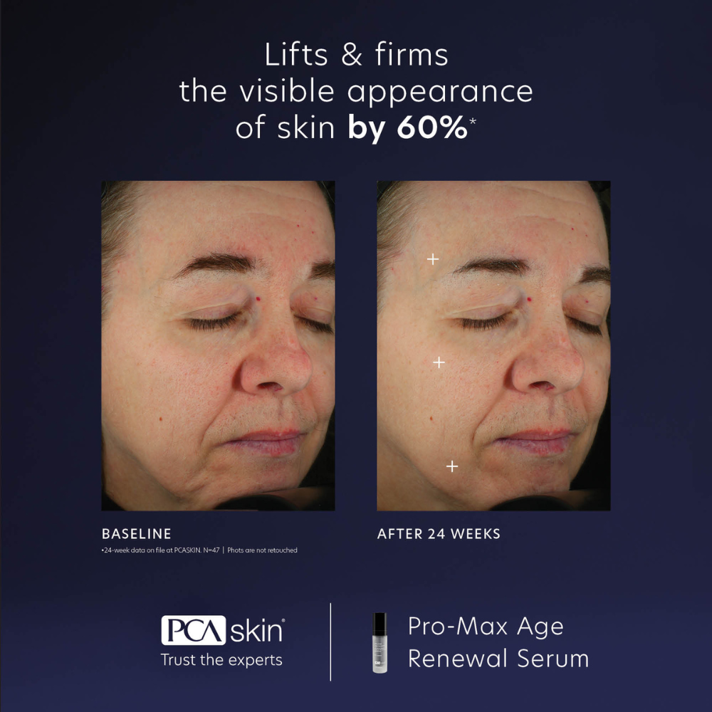 Load image into Gallery viewer, PCA Skin ProMax Age Renewal Serum 29ml