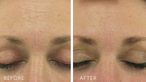 Load image into Gallery viewer, Biopelle Retriderm Serum Plus 30ml