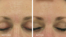 Load image into Gallery viewer, Biopelle Retriderm Serum Plus 30ml
