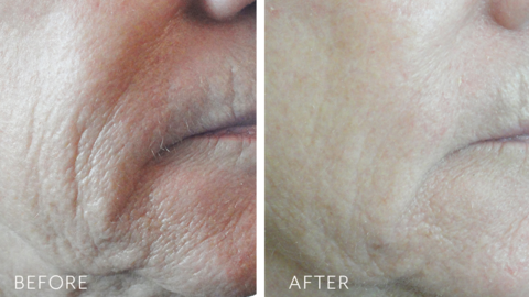 Load image into Gallery viewer, Biopelle Retriderm Serum Plus 30ml