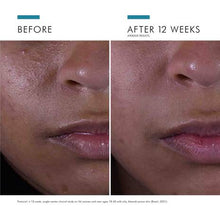Load image into Gallery viewer, SkinCeuticals Silymarin CF 30ml