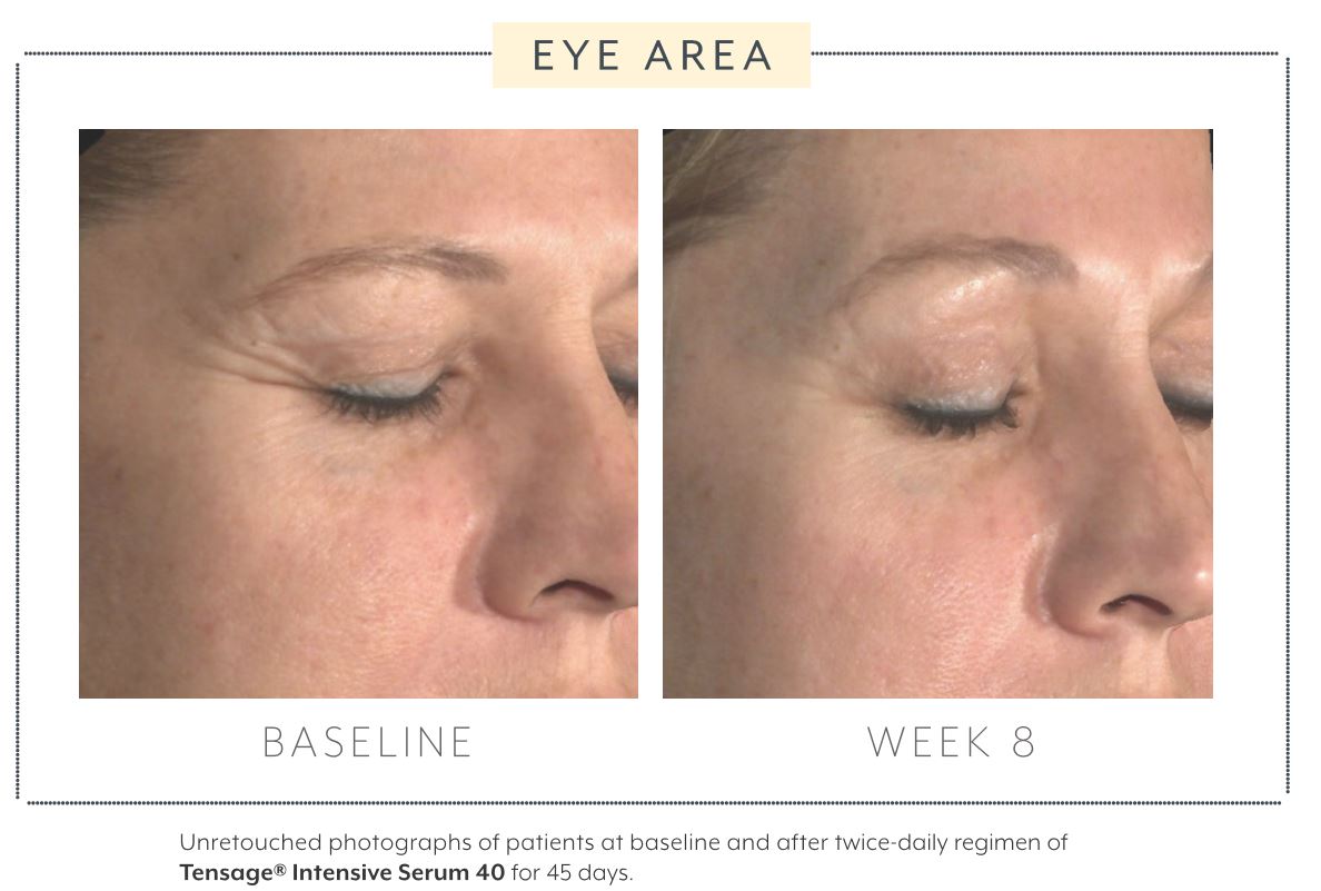 Load image into Gallery viewer, Biopelle Tensage Intensive Serum 40 10x Ampoules