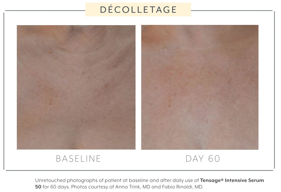 Load image into Gallery viewer, Biopelle Tensage Intensive Serum 50 10x Tubes