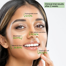 Load image into Gallery viewer, ThermoCeutical DeAC Aciderm Cream 50ml