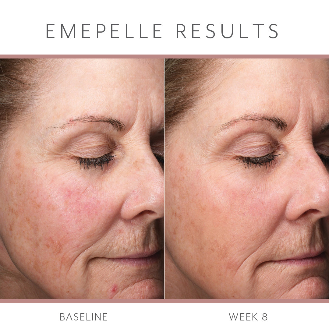 Load image into Gallery viewer, Emepelle Daily Serum 35ml
