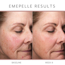 Load image into Gallery viewer, Emepelle Daily Serum 35ml