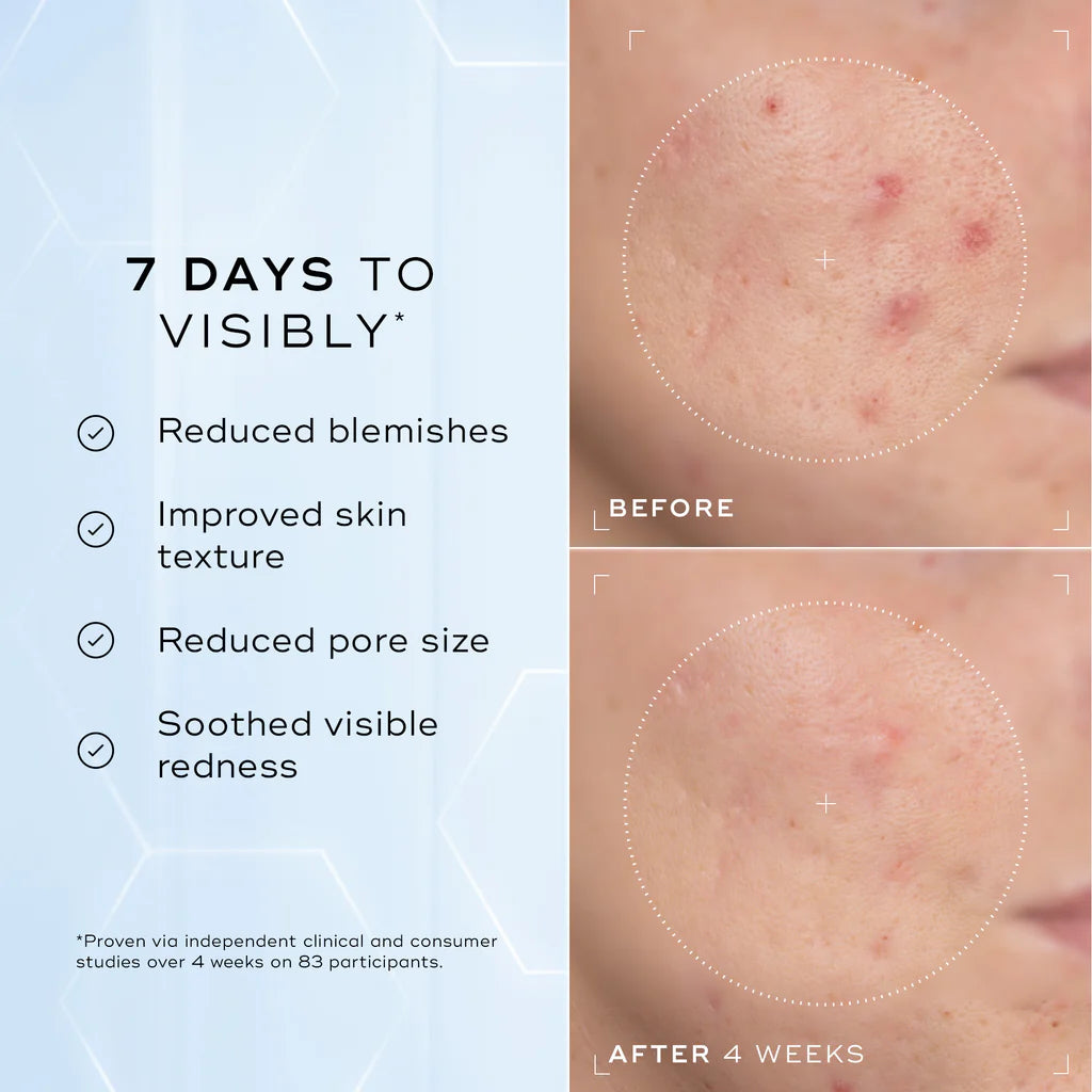 Load image into Gallery viewer, Medik8 Niacinamide Peptides 30ml
