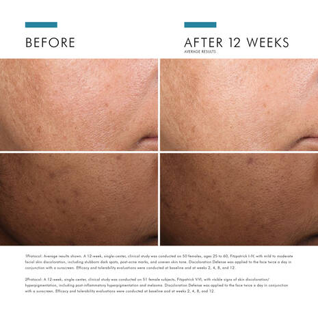 Load image into Gallery viewer, SkinCeuticals Discoloration Defense 30ml
