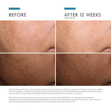 Load image into Gallery viewer, SkinCeuticals Discoloration Defense 30ml
