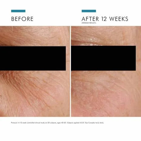 Load image into Gallery viewer, SkinCeuticals A.G.E Advanced Eye Complex 15ml
