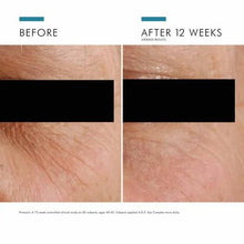 Load image into Gallery viewer, SkinCeuticals A.G.E Advanced Eye Complex 15ml
