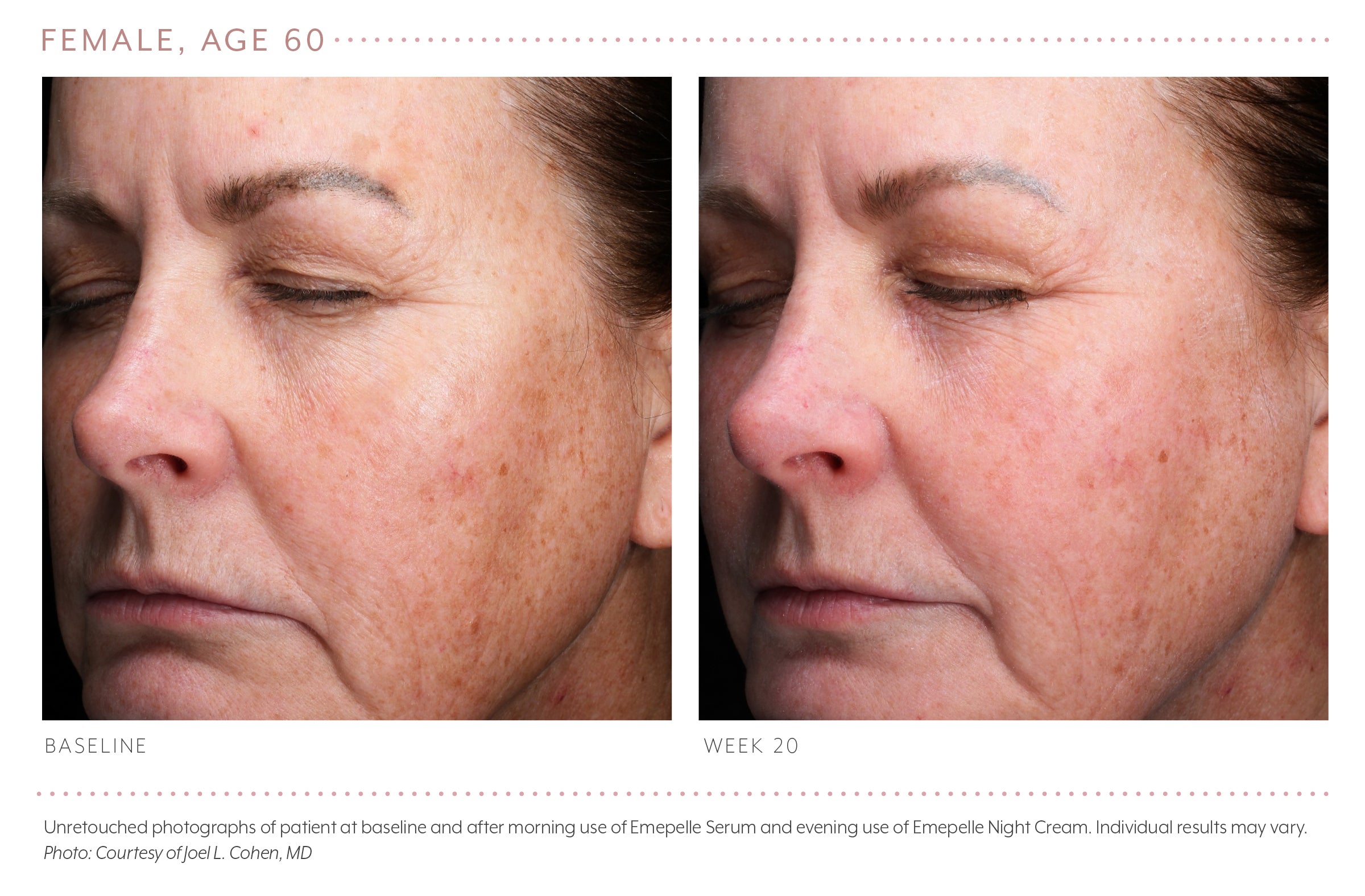 Load image into Gallery viewer, Emepelle Eye Cream 15ml
