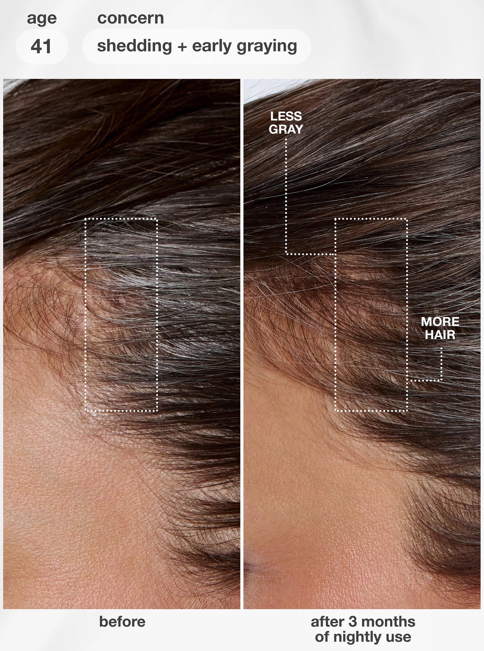 Load image into Gallery viewer, An informational graphic about scalp aging and hair shedding, with a large black hair silhouette split into external and internal sections. Text labels include lifestyle, air pollution, UV damage, bleach + color, chemical services, lack of sleep, hormonal changes, diet changes, and stress.
