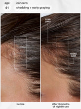 Load image into Gallery viewer, Before and after comparison of hair care product on scalp with less gray and more hair growth.
