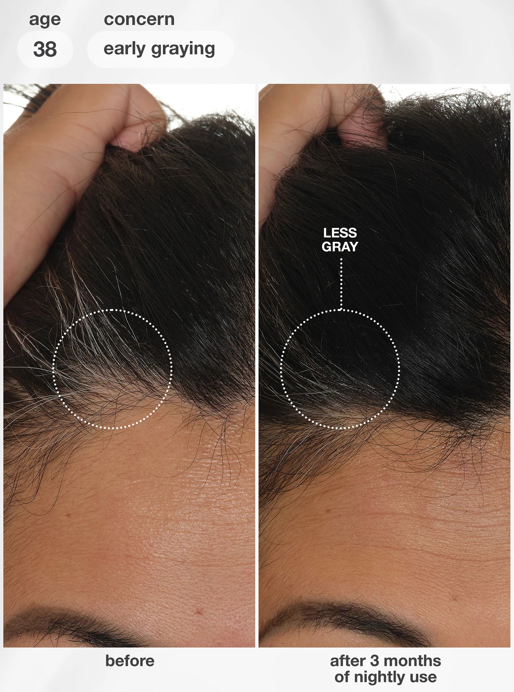 Load image into Gallery viewer, An informational graphic about scalp aging and hair shedding, with a large black hair silhouette split into external and internal sections. Text labels include lifestyle, air pollution, UV damage, bleach + color, chemical services, lack of sleep, hormonal changes, diet changes, and stress.
