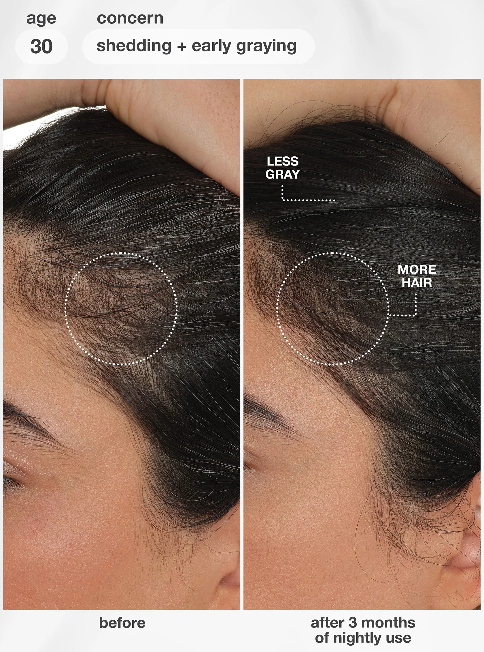 Load image into Gallery viewer, An informational graphic about scalp aging and hair shedding, with a large black hair silhouette split into external and internal sections. Text labels include lifestyle, air pollution, UV damage, bleach + color, chemical services, lack of sleep, hormonal changes, diet changes, and stress.
