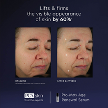 Load image into Gallery viewer, PCA Skin ProMax Age Renewal Serum 29ml
