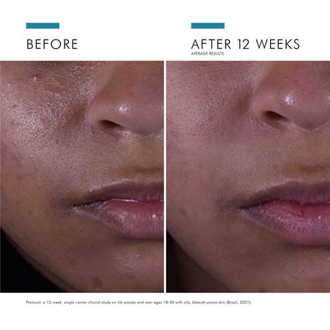 Load image into Gallery viewer, SkinCeuticals Silymarin CF 30ml
