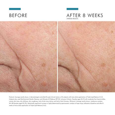 Load image into Gallery viewer, SkinCeuticals Triple Lipid Restore 242 Anti-Ageing Moisturiser 48ml
