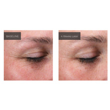 Load image into Gallery viewer, Emepelle Eye Cream 15ml
